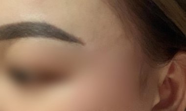 Wanita Cantik Melaporkan Penganiayaan oleh Pacar ke Polisi