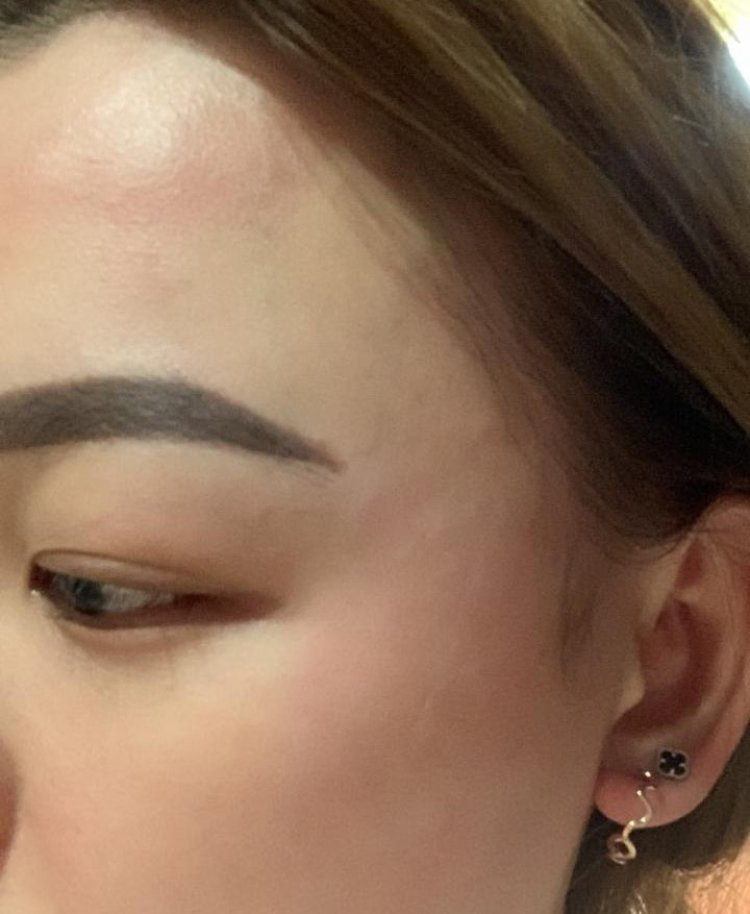 Wanita Cantik Melaporkan Penganiayaan oleh Pacar ke Polisi