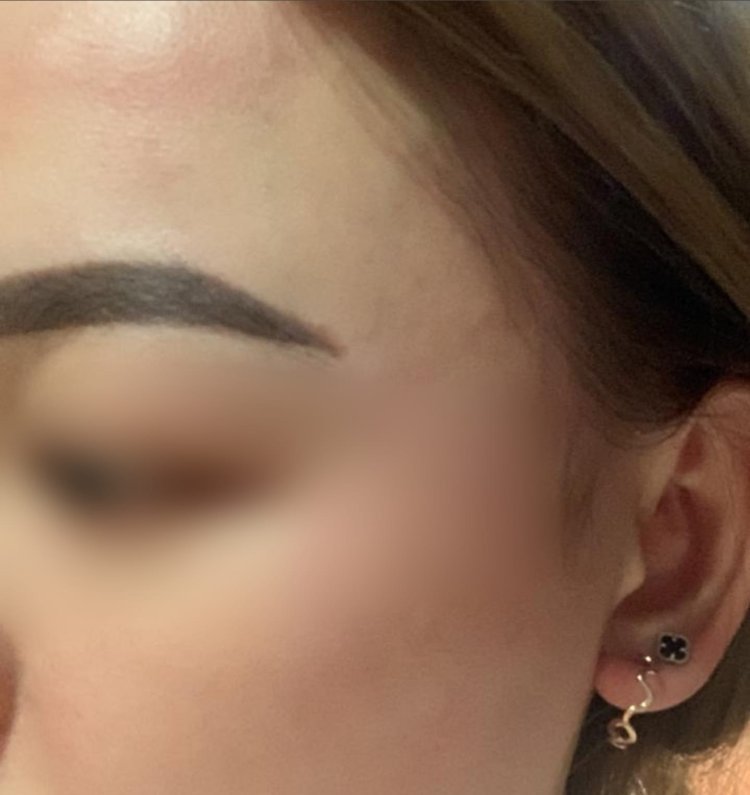 Wanita Cantik Melaporkan Penganiayaan oleh Pacar ke Polisi