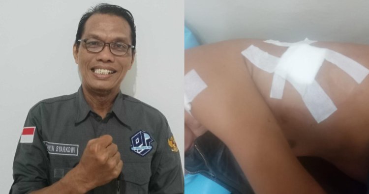 DPD Pro Jurnalismedia Siber Sumsel Meminta Polrestabes Palembang Turun Tangan Tangkap Pelaku Penusukan